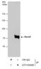 RecQ Like Helicase antibody, GTX100085, GeneTex, Immunoprecipitation image 