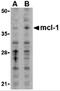 MCL1 Apoptosis Regulator, BCL2 Family Member antibody, 3479, ProSci, Western Blot image 