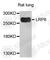 LDL Receptor Related Protein 6 antibody, A6134, ABclonal Technology, Western Blot image 