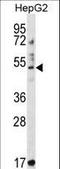 Tripartite Motif Containing 11 antibody, LS-C157267, Lifespan Biosciences, Western Blot image 