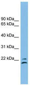 Tetraspanin-1 antibody, TA332053, Origene, Western Blot image 