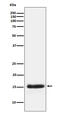 Placental Growth Factor antibody, M01164-1, Boster Biological Technology, Western Blot image 