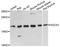 Suppressor Of Cytokine Signaling 1 antibody, STJ110065, St John