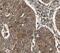 Choline/Ethanolamine Phosphotransferase 1 antibody, FNab01611, FineTest, Immunohistochemistry frozen image 