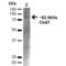 Choline acetyltransferase antibody, LS-C777287, Lifespan Biosciences, Western Blot image 