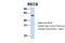 REC8 Meiotic Recombination Protein antibody, 26-275, ProSci, Western Blot image 