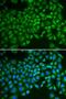 Selectin E antibody, GTX54691, GeneTex, Immunocytochemistry image 