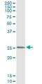 Frataxin antibody, H00002395-M01, Novus Biologicals, Immunoprecipitation image 