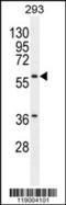 Carboxypeptidase A2 antibody, 55-858, ProSci, Western Blot image 