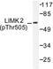 LIM Domain Kinase 2 antibody, LS-C177921, Lifespan Biosciences, Western Blot image 