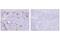 T Cell Immunoglobulin And Mucin Domain Containing 4 antibody, 75484T, Cell Signaling Technology, Immunohistochemistry paraffin image 