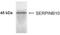 Serpin Family B Member 10 antibody, NBP2-24382, Novus Biologicals, Western Blot image 