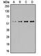Serum/Glucocorticoid Regulated Kinase 1 antibody, MBS821655, MyBioSource, Western Blot image 