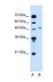 Mannosyl (Alpha-1,6-)-Glycoprotein Beta-1,2-N-Acetylglucosaminyltransferase antibody, NBP1-69335, Novus Biologicals, Western Blot image 