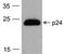 HIV-1 p17 antibody, TA160226, Origene, Western Blot image 