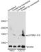 Stathmin 1 antibody, AP0229, ABclonal Technology, Western Blot image 