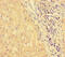 Heat Shock Protein Family A (Hsp70) Member 13 antibody, MBS719475, MyBioSource, Immunohistochemistry paraffin image 