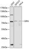 Granulin Precursor antibody, A00893, Boster Biological Technology, Western Blot image 