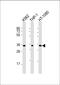Transmembrane Protein 158 (Gene/Pseudogene) antibody, 61-151, ProSci, Western Blot image 