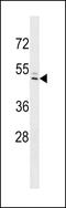 Interferon Induced Protein 44 Like antibody, 60-134, ProSci, Western Blot image 