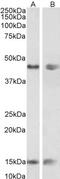 Patatin Like Phospholipase Domain Containing 3 antibody, LS-B5900, Lifespan Biosciences, Western Blot image 