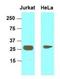 High Mobility Group Box 1 antibody, NBP1-07087, Novus Biologicals, Western Blot image 