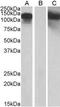 Cadherin 11 antibody, NBP1-52046, Novus Biologicals, Western Blot image 