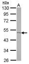 Acyl-CoA Thioesterase 9 antibody, LS-C155434, Lifespan Biosciences, Western Blot image 