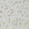 Dehydrogenase/Reductase 9 antibody, 22-128, ProSci, Immunohistochemistry paraffin image 