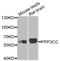 Protein Phosphatase 3 Catalytic Subunit Gamma antibody, A07461, Boster Biological Technology, Western Blot image 