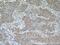 Beta-secretase 2 antibody, 16321-1-AP, Proteintech Group, Immunohistochemistry paraffin image 