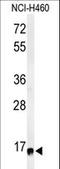 Ribosomal Protein S13 antibody, LS-C162730, Lifespan Biosciences, Western Blot image 