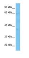 Tripartite Motif Containing 8 antibody, orb324565, Biorbyt, Western Blot image 