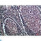 CD1a Molecule antibody, LS-C813792, Lifespan Biosciences, Immunohistochemistry paraffin image 
