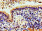 Histone Cluster 1 H1 Family Member C antibody, LS-C670329, Lifespan Biosciences, Immunohistochemistry paraffin image 