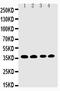 Eukaryotic Translation Initiation Factor 2 Subunit Alpha antibody, PA2029, Boster Biological Technology, Western Blot image 