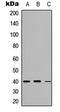 AKT1 Substrate 1 antibody, LS-C358409, Lifespan Biosciences, Western Blot image 