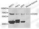 Diacylglycerol Kinase Epsilon antibody, A7752, ABclonal Technology, Western Blot image 