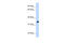 MAX Dimerization Protein MLX antibody, 27-862, ProSci, Western Blot image 