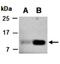 Isocitrate Dehydrogenase (NADP(+)) 2, Mitochondrial antibody, orb67195, Biorbyt, Western Blot image 
