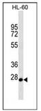 Mediator Complex Subunit 22 antibody, AP52652PU-N, Origene, Western Blot image 