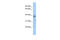 Zinc Finger Protein 625 antibody, 25-561, ProSci, Enzyme Linked Immunosorbent Assay image 