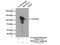 Mtr4 Exosome RNA Helicase antibody, 12719-2-AP, Proteintech Group, Immunoprecipitation image 