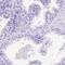 Pregnancy Specific Beta-1-Glycoprotein 11 antibody, PA5-59926, Invitrogen Antibodies, Immunohistochemistry frozen image 