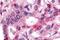 MINOR antibody, NLS2341, Novus Biologicals, Immunohistochemistry paraffin image 