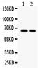 Transforming Growth Factor Beta Receptor 2 antibody, LS-C313005, Lifespan Biosciences, Western Blot image 