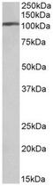 Adaptor Related Protein Complex 2 Subunit Alpha 1 antibody, AP32069PU-N, Origene, Western Blot image 