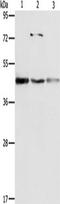 NFKB Inhibitor Beta antibody, TA349227, Origene, Western Blot image 
