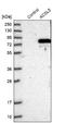 Acyl-CoA Synthetase Long Chain Family Member 5 antibody, NBP2-31995, Novus Biologicals, Western Blot image 