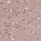 Zinc Finger Protein 292 antibody, PA5-65628, Invitrogen Antibodies, Immunohistochemistry frozen image 
